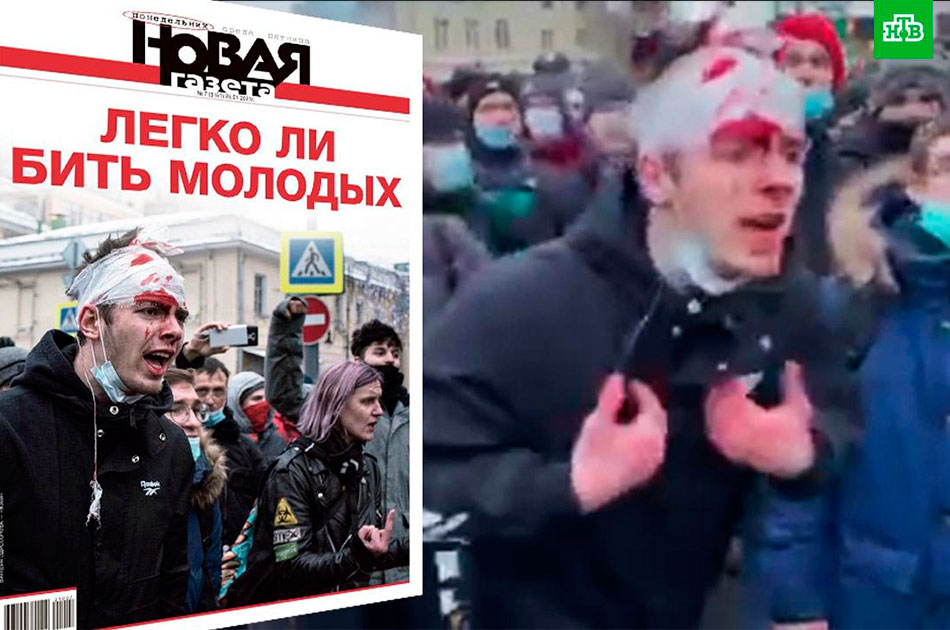 Эхо митингов «за Навального»: подростку с фейковой кровавой повязкой дали 4,5 года колонии